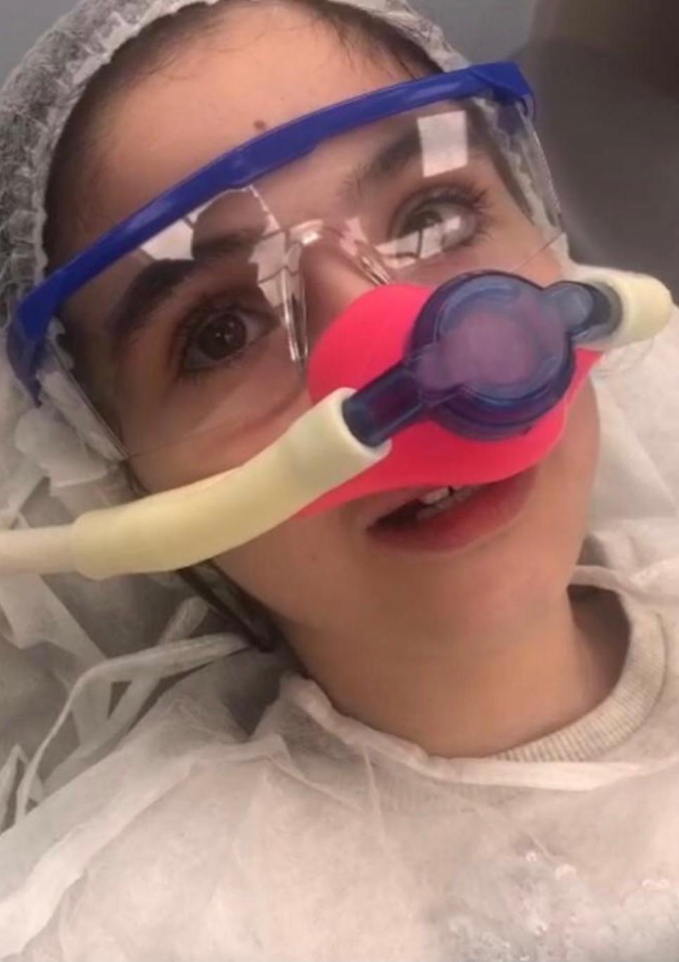 Conscious sedation (laughing gas)