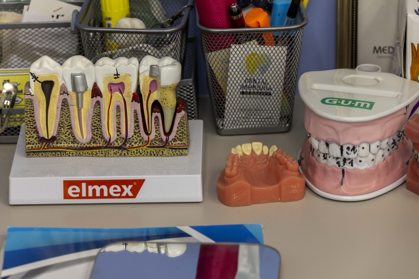 Dental implants