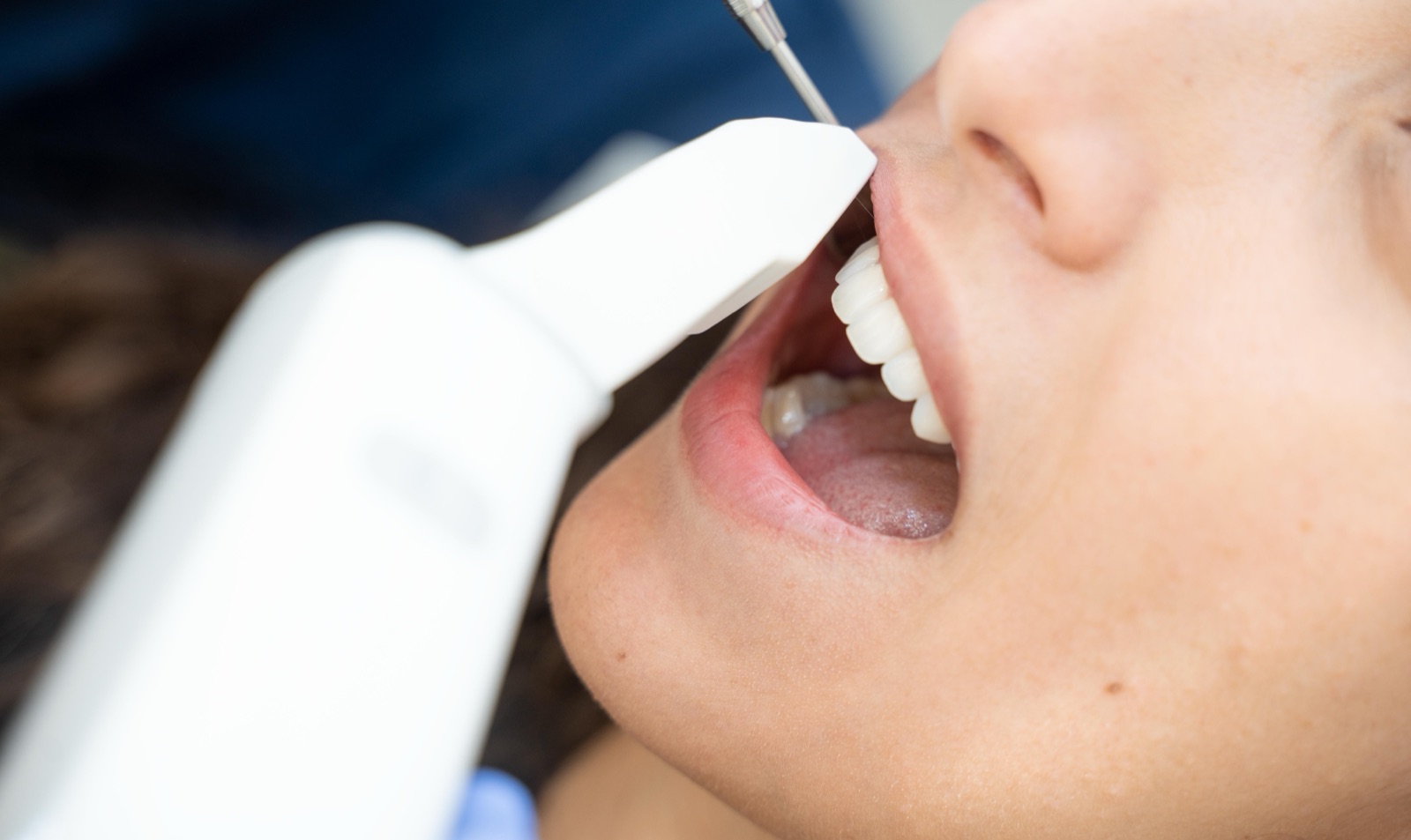 Laser treatment